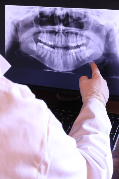 Best Tooth Pain Emergency Relief  in Gilroy, CA